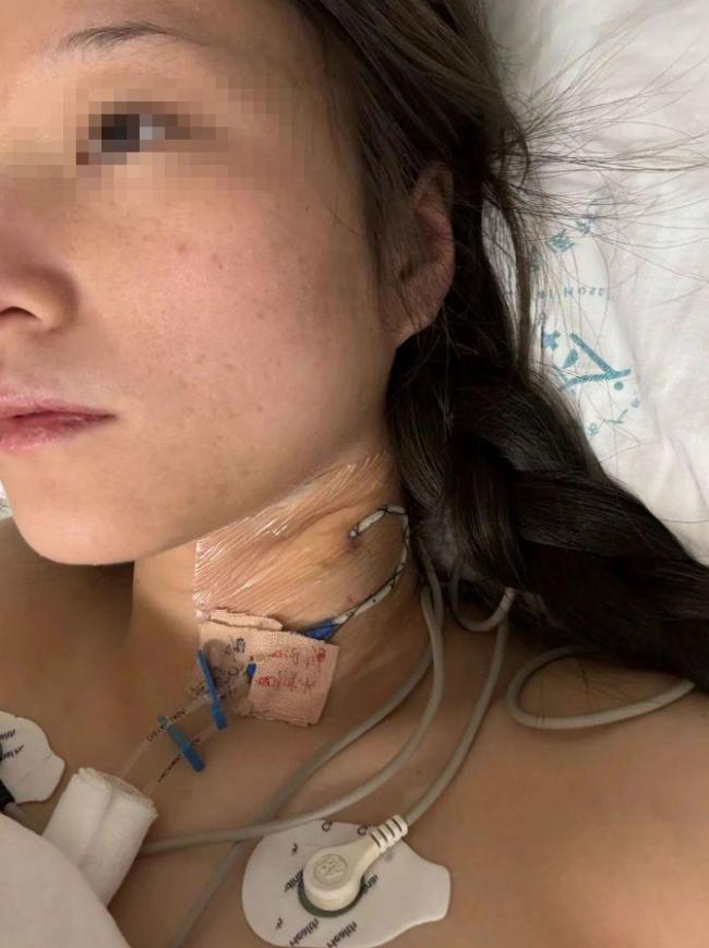 男子驾车出事致女友截瘫 双方发声 男友失联拒付医疗费